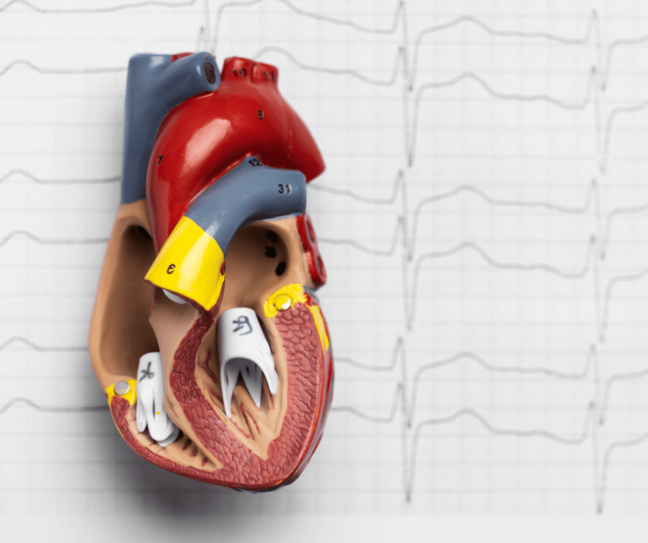 tipos de miocardiopatia